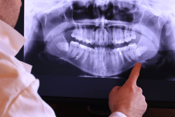 Best Urgent Tooth Repair  in Rockwell Place, TX