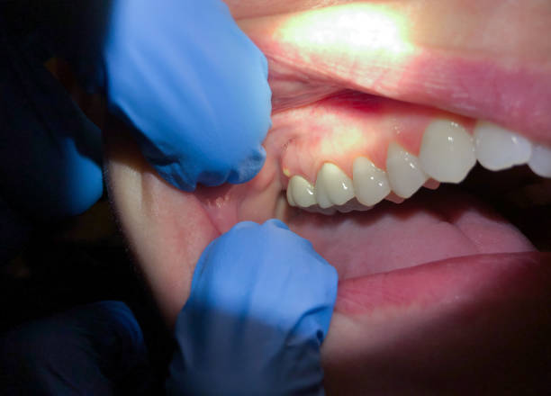 Best Root Canal Emergency Dentist  in Rockwell Place, TX