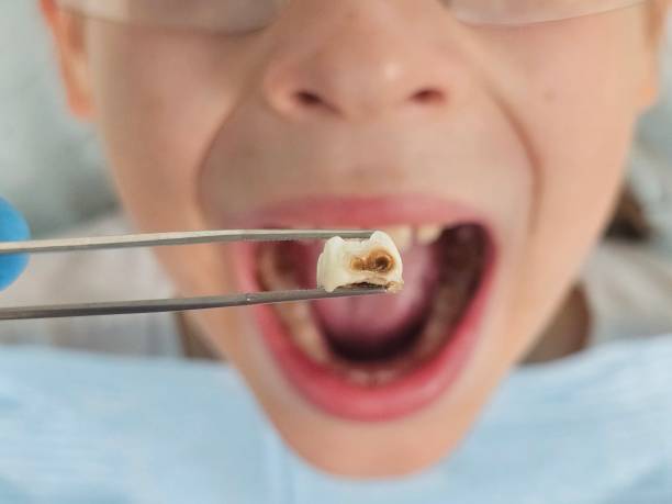Best Dental Emergency Near Me  in Rockwell Place, TX